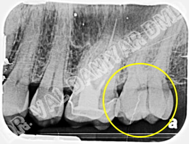 emergency dental care 2