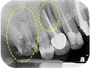 oral surgery2