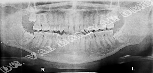 oral surgery5