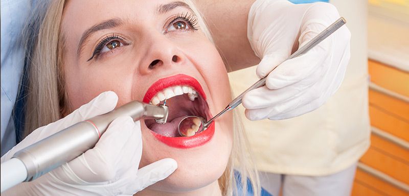 Tooth Extractions | Naples, Fl